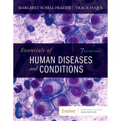 Essentials of Human Diseases and Conditions - E-Book : Essentials of Human Diseases and Conditions - E-Book